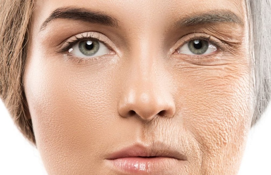 What is the skin aging process