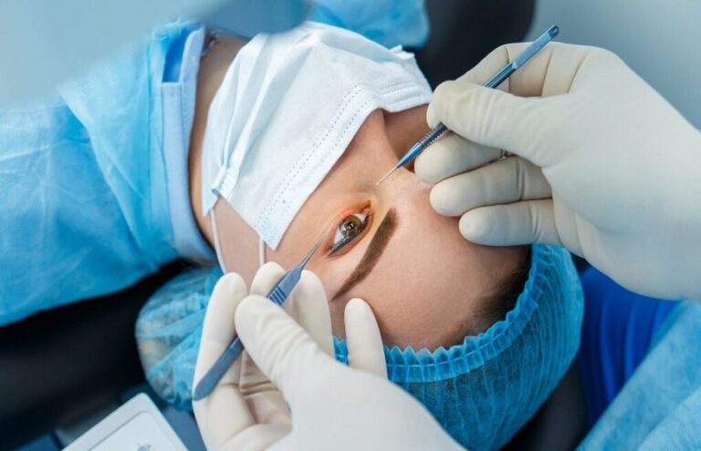 Excimer laser eye surgery or refractive surgery