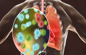 When to See a Pneumonia Specialist: Key Signs to Watch For?